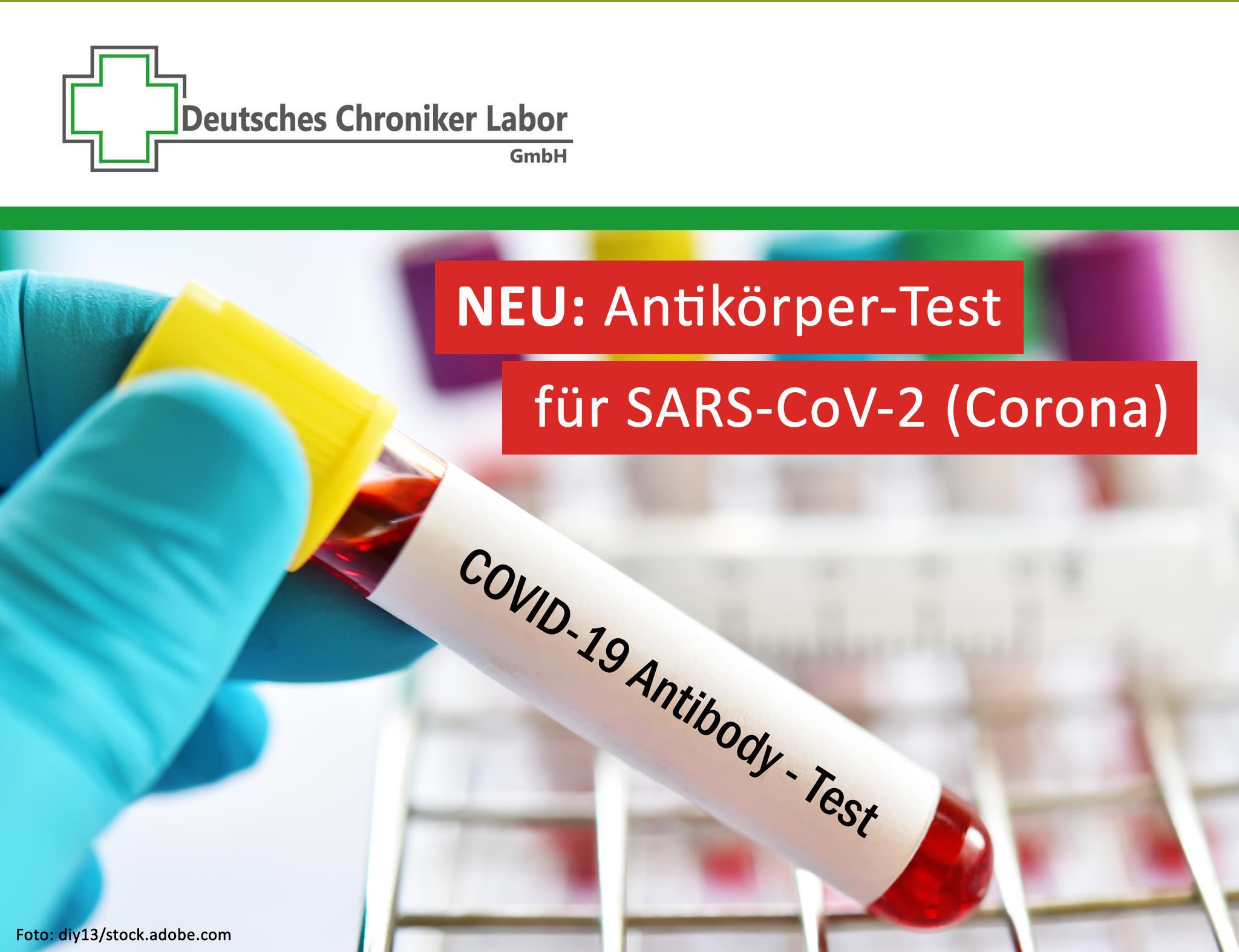 NEU: Antikörper-Test für SARS-CoV-2 (Corona)