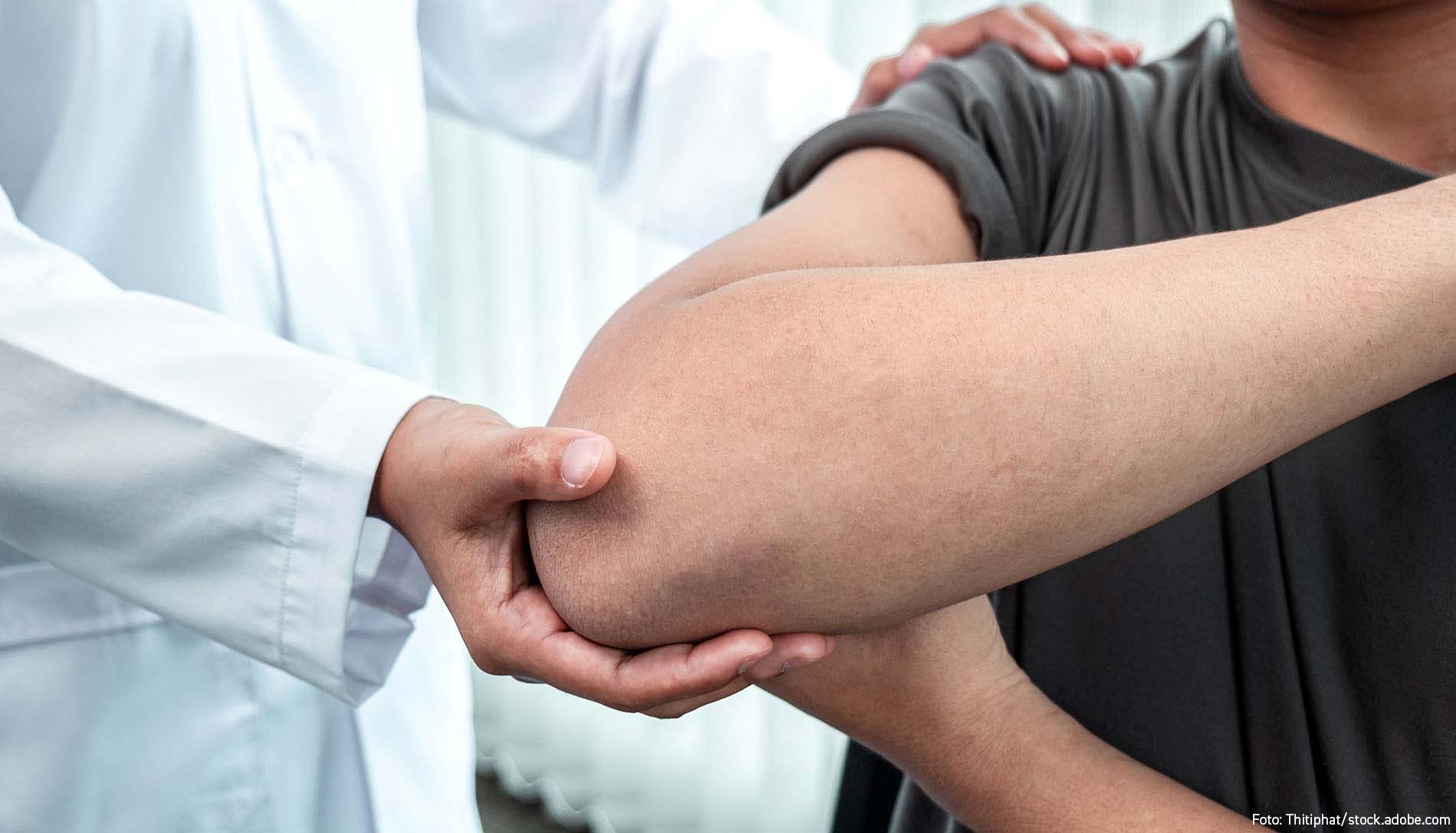 3.Borreliose oder doch ALS Ein Erfahrungsbericht Foto Thitiphat stock adobe