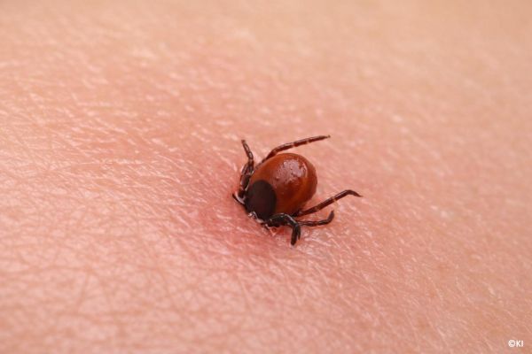 Zeckenstich ohne Rötung: Kann es trotzdem Borreliose sein?