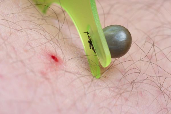 Nicht nur FSME, Borreliose & Co: Zecken können auch Lähmungen hervorrufen
