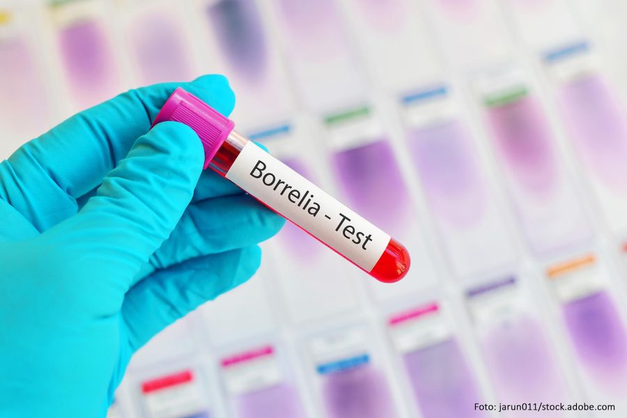 Borreliose Symptome und Borreliose Test